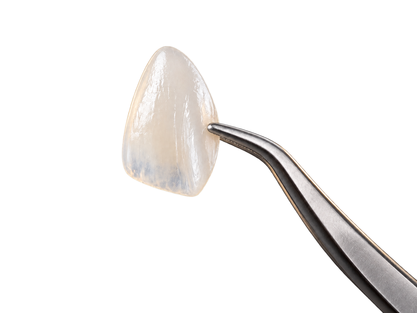 Conceptual illustration of veneers or whitening: where do you start?